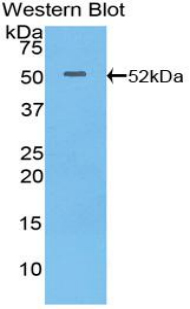 ITGA6/Integrin Alpha 6/CD49f Antibody - Western blot of recombinant ITGA6/Integrin Alpha 6/CD49f.  This image was taken for the unconjugated form of this product. Other forms have not been tested.