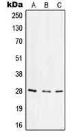 ITGA6/Integrin Alpha 6/CD49f Antibody - Western blot analysis of CD49f LC expression in HeLa UV-treated (A); SP2/0 UV-treated (B); PC12 LPS-treated (C) whole cell lysates.