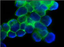 ITGA6/Integrin Alpha 6/CD49f Antibody - Immunostaining of human ovarian carcinoma cells (cell line:OVCAR-3)