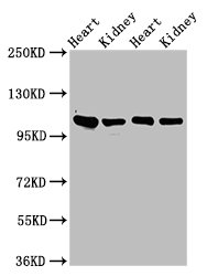ITGA6/Integrin Alpha 6/CD49f Antibody - Positive Western Blot detected in Rat heart tissue, Rat kidney tissue, Mouse heart tisseu, Mouse kidney tissue. All lanes: ITGA6 antibody at 3 µg/ml Secondary Goat polyclonal to rabbit IgG at 1/50000 dilution. Predicted band size: 127, 120, 123, 122, 125, 107 KDa. Observed band size: 100 KDa