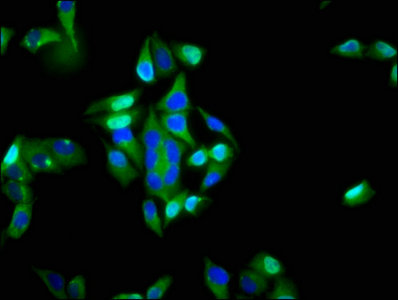 ITGA6/Integrin Alpha 6/CD49f Antibody - Immunofluorescence staining of Hela cells with ITGA6 Antibody at 1:200, counter-stained with DAPI. The cells were fixed in 4% formaldehyde, permeabilized using 0.2% Triton X-100 and blocked in 10% normal Goat Serum. The cells were then incubated with the antibody overnight at 4°C. The secondary antibody was Alexa Fluor 488-congugated AffiniPure Goat Anti-Rabbit IgG(H+L).