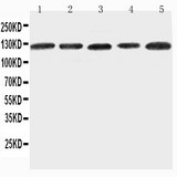 ITGA7 / Integrin Alpha 7 Antibody - WB of ITGA7 / Integrin Alpha 7 antibody. Lane 1: 293T Cell Lysate. Lane 2: A431 Cell Lysate. Lane 3: HELA Cell Lysate. Lane 4: JURKAT Cell Lysate. Lane 5: RAJI Cell Lysate.