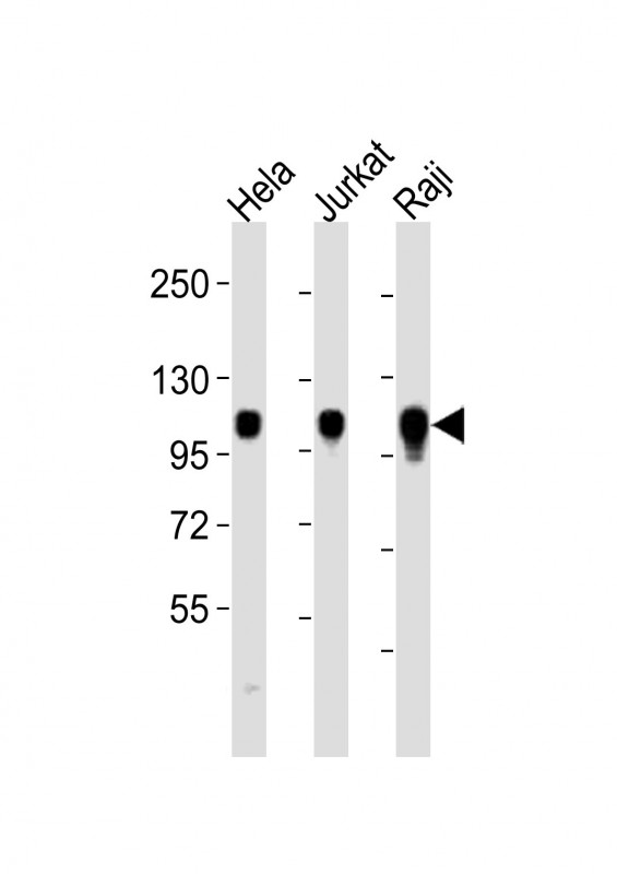 ITGA7 / Integrin Alpha 7 Antibody - All lanes : Anti-ITGA7 Antibody at 1:2000 dilution Lane 1: HeLa whole cell lysates Lane 2: Jurkat whole cell lysates Lane 3: Raji whole cell lysates Lysates/proteins at 20 ug per lane. Secondary Goat Anti-Rabbit IgG, (H+L), Peroxidase conjugated at 1/10000 dilution Predicted band size : 129 kDa Blocking/Dilution buffer: 5% NFDM/TBST.