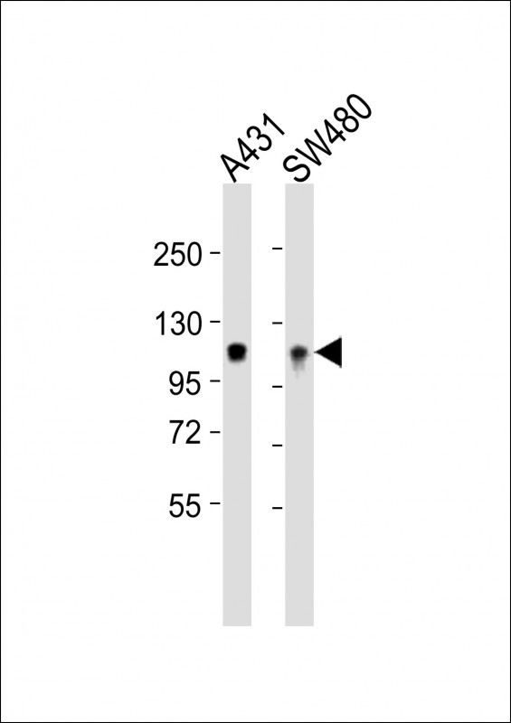 ITGA7 / Integrin Alpha 7 Antibody - All lanes : Anti-ITGA7 Antibody at 1:8000 dilution Lane 1: A431 whole cell lysates Lane 2: SW480 whole cell lysates Lysates/proteins at 20 ug per lane. Secondary Goat Anti-Rabbit IgG, (H+L), Peroxidase conjugated at 1/10000 dilution Predicted band size : 129 kDa Blocking/Dilution buffer: 5% NFDM/TBST.