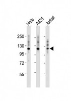 ITGA7 / Integrin Alpha 7 Antibody - All lanes : Anti-ITGA7 Antibody at 1:2000 dilution Lane 1: HeLa whole cell lysates Lane 2: A431 whole cell lysates Lane 3: Jurkat whole cell lysates Lysates/proteins at 20 ug per lane. Secondary Goat Anti-Rabbit IgG, (H+L), Peroxidase conjugated at 1/10000 dilution Predicted band size : 129 kDa Blocking/Dilution buffer: 5% NFDM/TBST.