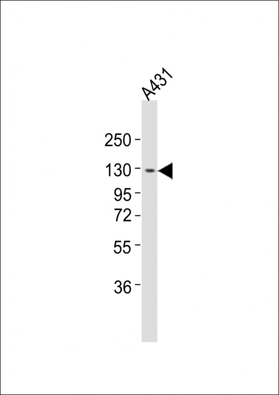 ITGA7 / Integrin Alpha 7 Antibody - Anti-ITGA7 Antibody at 1:4000 dilution + A431 whole cell lysates Lysates/proteins at 20 ug per lane. Secondary Goat Anti-Rabbit IgG, (H+L), Peroxidase conjugated at 1/10000 dilution Predicted band size : 129 kDa Blocking/Dilution buffer: 5% NFDM/TBST.