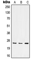 ITGA7 / Integrin Alpha 7 Antibody - Western blot analysis of Integrin alpha 7 LC expression in HeLa LPS-treated (A); Raw264.7 UV-treated (B); PC12 UV-treated (C) whole cell lysates.