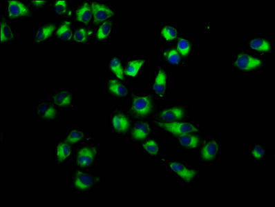 ITGA7 / Integrin Alpha 7 Antibody - Immunofluorescence staining of Hela cells diluted at 1:233, counter-stained with DAPI. The cells were fixed in 4% formaldehyde, permeabilized using 0.2% Triton X-100 and blocked in 10% normal Goat Serum. The cells were then incubated with the antibody overnight at 4°C.The Secondary antibody was Alexa Fluor 488-congugated AffiniPure Goat Anti-Rabbit IgG (H+L).