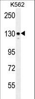 ITGA8 / Integrin Alpha 8 Antibody - ITGA8 Antibody western blot of K562 cell line lysates (35 ug/lane). The ITGA8 antibody detected the ITGA8 protein (arrow).