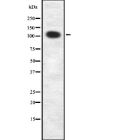 ITGA8 / Integrin Alpha 8 Antibody - Western blot analysis ITGA8 using LOVO cells whole cells lysates
