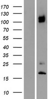 ITGA8 / Integrin Alpha 8 Protein - Western validation with an anti-DDK antibody * L: Control HEK293 lysate R: Over-expression lysate