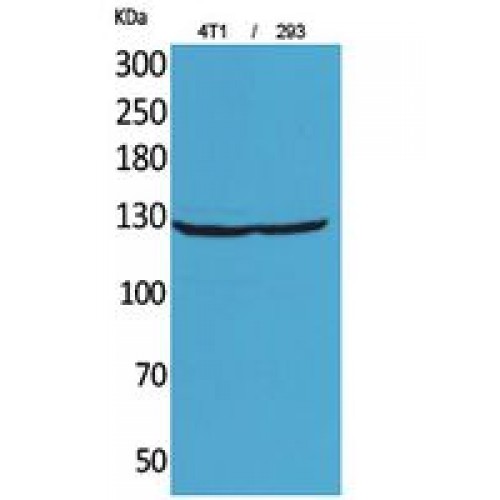 ITGAD / CD11d Antibody - Western blot of Integrin alphaD antibody