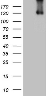 ITGAD / CD11d Antibody - HEK293T cells were transfected with the pCMV6-ENTRY control. (Left lane) or pCMV6-ENTRY ITGAD. (Right lane) cDNA for 48 hrs and lysed