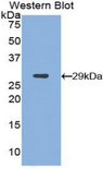 ITGAD / CD11d Antibody - Western blot of recombinant ITGAD / CD11d encoding aa 886-1106.  This image was taken for the unconjugated form of this product. Other forms have not been tested.
