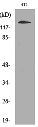 ITGAD / CD11d Antibody - Western blot analysis of lysate from 4T1 cells, using ITGAD Antibody.