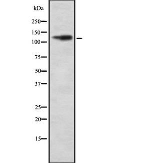 ITGAD / CD11d Antibody - Western blot analysis ITGAD using COLO205 whole cells lysates