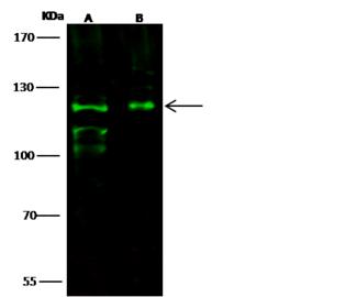 ITGAE / CD103 Antibody - Anti- rabbit polyclonal antibody at 1:500 dilution. Lane A: Hela Whole Cell Lysate. Lane B: A431 Whole Cell Lysate. Lysates/proteins at 30 ug per lane. Secondary: Goat Anti-Rabbit IgG H&L (Dylight800) at 1/10000 dilution. Developed using the Odyssey technique. Performed under reducing conditions. Predicted band size: 130 kDa. Observed band size: 120 kDa. (We are unsure as to the identity of these extra bands.)
