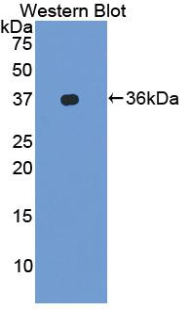 ITGAL / CD11a Antibody - Western blot of recombinant LFA-1 / CD11a.