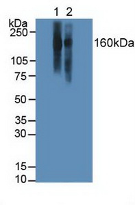 ITGAL / CD11a Antibody - Western Blot; Sample:Lane1: Human Jurkat Cells; Lane2: Human Raji Cells.