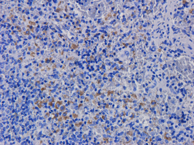 ITGAL / CD11a Antibody - Flow-cytometry on human lymphocytes.