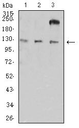 ITGAL / CD11a Antibody - Western blot analysis using CD11a mouse mAb against HL-60 (1), A549 (2), and SW620 (3) cell lysate.