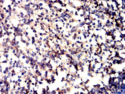 ITGAL / CD11a Antibody - Immunohistochemical analysis of paraffin-embedded tonsil tissues using CD11a mouse mAb with DAB staining.