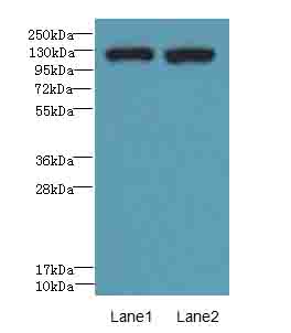 ITGAL / CD11a Antibody - Western blot. All lanes: ITGAL antibody at 8 ug/ml. Lane 1: A549 whole cell lysate. Lane 2: HepG-2 whole cell lysate. Secondary Goat polyclonal to Rabbit IgG at 1:10000 dilution. Predicted band size: 129 kDa. Observed band size: 129 kDa.