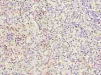 ITGAL / CD11a Antibody - Immunohistochemistry of paraffin-embedded human spleen tissue using antibody at dilution of 1:100.
