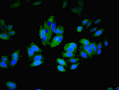 ITGAL / CD11a Antibody - Immunofluorescent analysis of HepG2 cells using ITGAL Antibody at dilution of 1:100 and Alexa Fluor 488-congugated AffiniPure Goat Anti-Rabbit IgG(H+L)