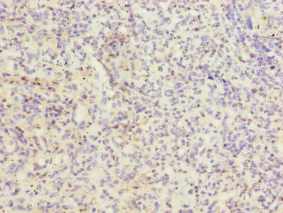 ITGAL / CD11a Antibody - Immunohistochemistry of paraffin-embedded human spleen tissue using ITGAL Antibody at dilution of 1:100