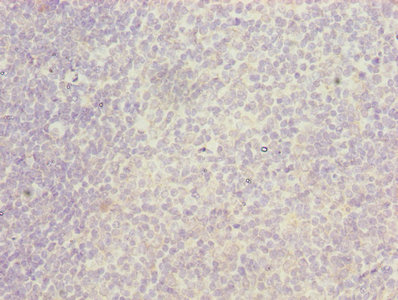 ITGAL / CD11a Antibody - Immunohistochemistry of paraffin-embedded human tonsil tissue using ITGAL Antibody at dilution of 1:100
