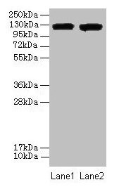 ITGAL / CD11a Antibody - Western blot All lanes: ITGAL antibody at 8µg/ml Lane 1: A549 whole cell lysate Lane 2: HepG2 whole cell lysate Secondary Goat polyclonal to rabbit IgG at 1/10000 dilution Predicted band size: 129, 135, 120 kDa Observed band size: 129 kDa