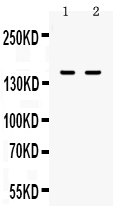 ITGAL / CD11a Antibody - Western blot - Anti-CD11a Picoband Antibody