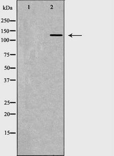 ITGAL / CD11a Antibody - Western blot analysis of HepG2 whole cells lysates using ITGAL antibody. The lane on the left is treated with the antigen-specific peptide.