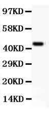 ITGAM / CD11b Antibody - CD11b antibody , . All lanes: Anti CD11B at 0.5 ug/ml. WB: Recombinant Human CD11B Protein 0.5ng. Predicted band size: 45 kD. Observed band size: 45 kD.