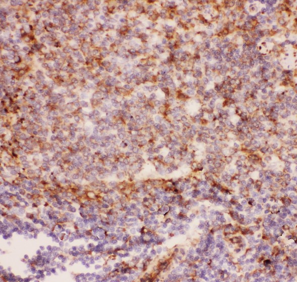 ITGAM / CD11b Antibody - CD11b antibody IHC-paraffin: Rat Spleen Tissue.