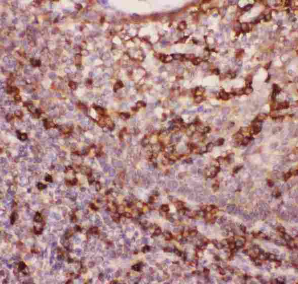 ITGAM / CD11b Antibody - Anti-CD11b Picoband antibody, IHC(P): Human Tonsil Tissue