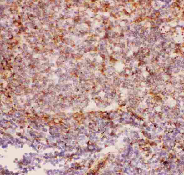 ITGAM / CD11b Antibody - Anti-CD11b Picoband antibody, IHC(P): Rat Spleen Tissue