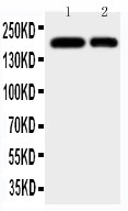 ITGAM / CD11b Antibody - CD11b antibody All Western blot. All lanes: Anti-ITGAM at 0.5 ug/ml. Lane 1: JURKAT Whole Cell Lysate at 40 ug. Lane 2: RAJI Whole Cell Lysate at 40 ug . Predicted band size: 127 kD . Observed band size: 170 kD.
