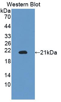 ITGAM / CD11b Antibody - Western blot of recombinant ITGAM / CD11b. This image was taken for the base form of this product. Alternate forms, such as conjugated, azide-free, or ready-to-use, have not been tested.