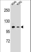 ITGAM / CD11b Antibody - CD11b Antibody western blot of A549,K562 cell line lysates (35 ug/lane). The CD11b antibody detected the CD11b protein (arrow).