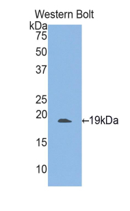 ITGAM / CD11b Antibody - Western blot of ITGAM / CD11b antibody.