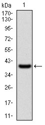 ITGAM / CD11b Antibody - Western blot using ITGAM monoclonal antibody against human ITGAM recombinant protein. (Expected MW is 37.5 kDa)