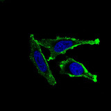 ITGAM / CD11b Antibody - Immunofluorescence of HeLa cells using ITGAM mouse monoclonal antibody (green). Blue: DRAQ5 fluorescent DNA dye.