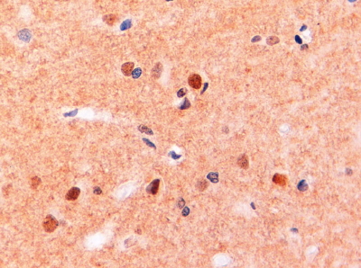 ITGAM / CD11b Antibody - ITGAM / CD11B Antibody (2µg/ml) staining of paraffin embedded Human Brain. Steamed antigen retrieval with Tris/EDTA buffer pH 9, HRP-staining. This data is from a previous batch, not on sale.
