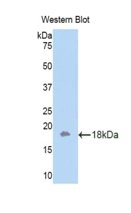 ITGAM / CD11b Antibody - Western blot of recombinant ITGAM / CD11b.  This image was taken for the unconjugated form of this product. Other forms have not been tested.