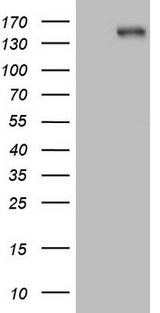 ITGAM / CD11b Antibody - HEK293T cells were transfected with the pCMV6-ENTRY control. (Left lane) or pCMV6-ENTRY ITGAM. (Right lane) cDNA for 48 hrs and lysed. Equivalent amounts of cell lysates. (5 ug per lane) were separated by SDS-PAGE and immunoblotted with anti-ITGAM. (1:500)