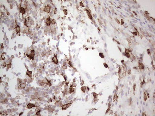 ITGAM / CD11b Antibody - Immunohistochemical staining of paraffin-embedded Human bladder tissue within the normal limits using anti-ITGAM mouse monoclonal antibody. (Heat-induced epitope retrieval by 1mM EDTA in 10mM Tris buffer. (pH8.5) at 120°C for 3 min. (1:150)
