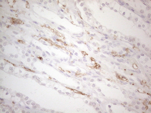 ITGAM / CD11b Antibody - Immunohistochemical staining of paraffin-embedded Human Kidney tissue within the normal limits using anti-ITGAM mouse monoclonal antibody. (Heat-induced epitope retrieval by 1mM EDTA in 10mM Tris buffer. (pH8.5) at 120°C for 3 min. (1:150)