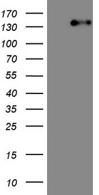 ITGAM / CD11b Antibody - HEK293T cells were transfected with the pCMV6-ENTRY control. (Left lane) or pCMV6-ENTRY ITGAM. (Right lane) cDNA for 48 hrs and lysed. Equivalent amounts of cell lysates. (5 ug per lane) were separated by SDS-PAGE and immunoblotted with anti-ITGAM. (1:500)